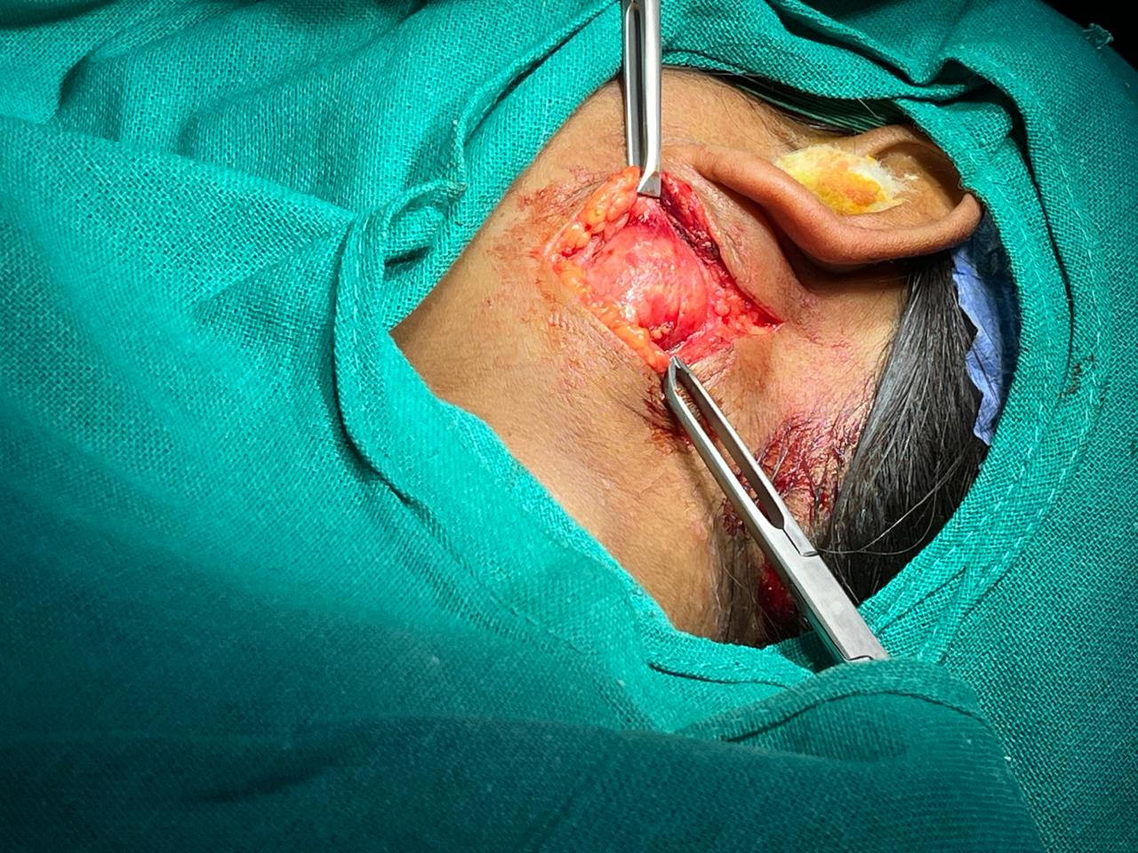 Lavekar Hospital(ENT)